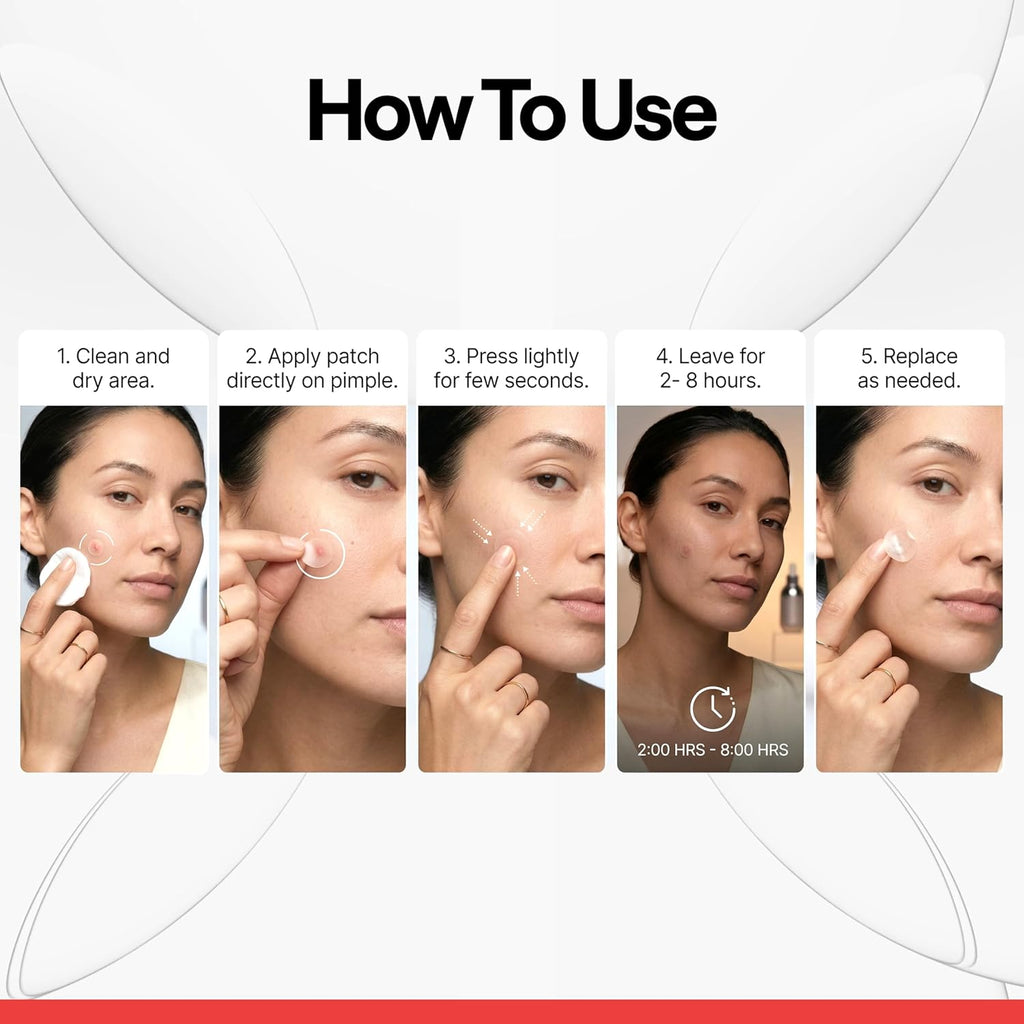 ELLE Magnesium Acne Patch |Micro-Dart | Magnesium - The Magic Mineral | Deep Penetrating Hydrocolloid Pimple Patch | Early Stage & Pus Pimples | Tea Tree & Madecassic Acid | 10 Patches