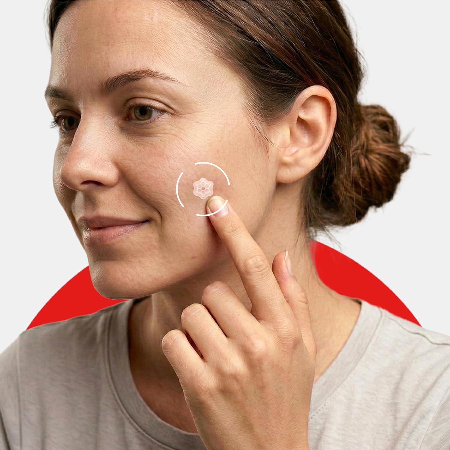 ELLE Magnesium Acne Patch |Micro-Dart | Magnesium - The Magic Mineral | Deep Penetrating Hydrocolloid Pimple Patch | Early Stage & Pus Pimples | Tea Tree & Madecassic Acid | 10 Patches