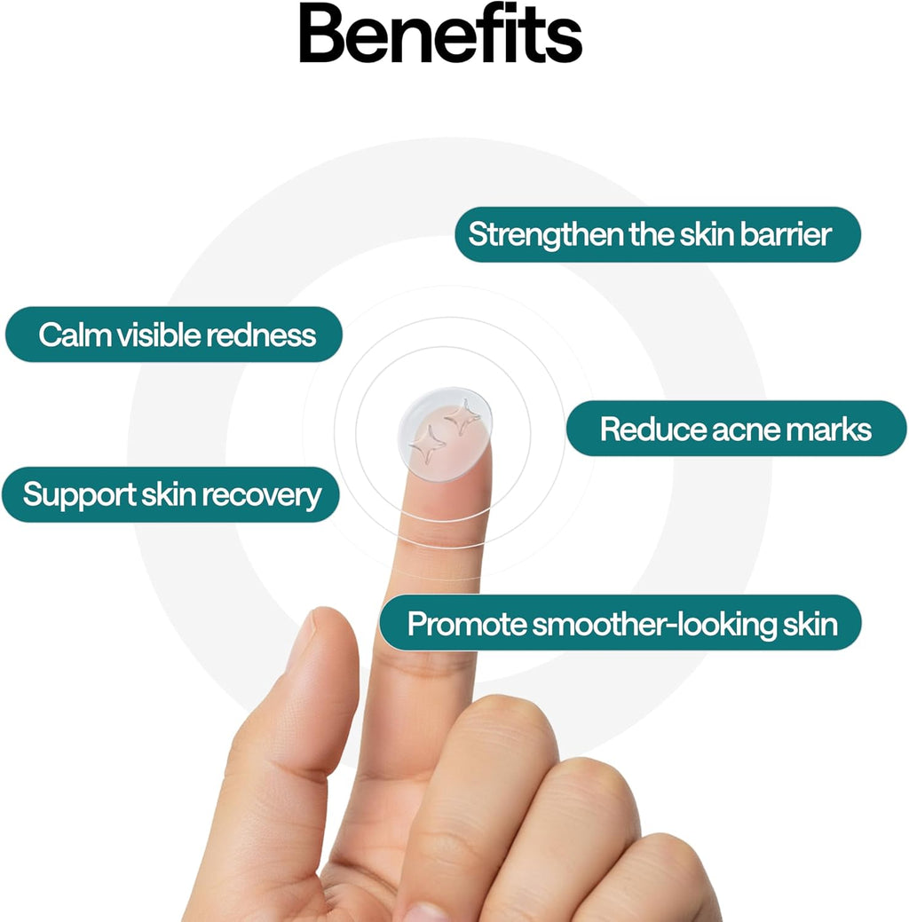 ELLE Magnesium Soft Acne Patch | Spot Treatment | Magnesium - The Magic Mineral |Hydrocolloid |Madecassic Acid | Tee Tree Oil Pimple Patches | Post-Breakout Acne Care | 11mm & 10mm Sizes | 45 Patches