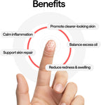 ELLE Magnesium Acne Patch |Micro-Dart | Magnesium - The Magic Mineral | Deep Penetrating Hydrocolloid Pimple Patch | Early Stage & Pus Pimples | Tea Tree & Madecassic Acid | 10 Patches