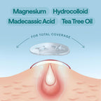 ELLE Magnesium Soft Acne Patch | Spot Treatment | Magnesium - The Magic Mineral |Hydrocolloid |Madecassic Acid | Tee Tree Oil Pimple Patches | Post-Breakout Acne Care | 11mm & 10mm Sizes | 45 Patches