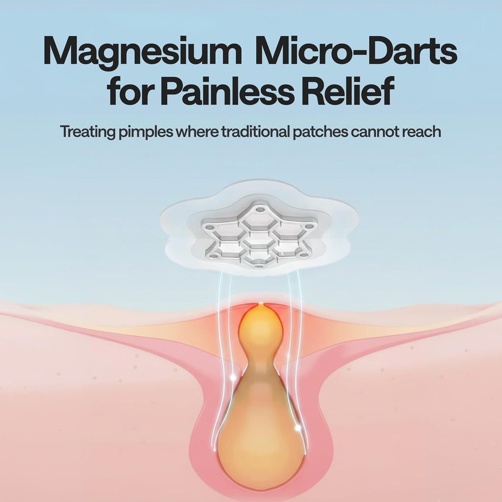 ELLE Magnesium Acne Patch |Micro-Dart | Magnesium - The Magic Mineral | Deep Penetrating Hydrocolloid Pimple Patch | Early Stage & Pus Pimples | Tea Tree & Madecassic Acid | 10 Patches