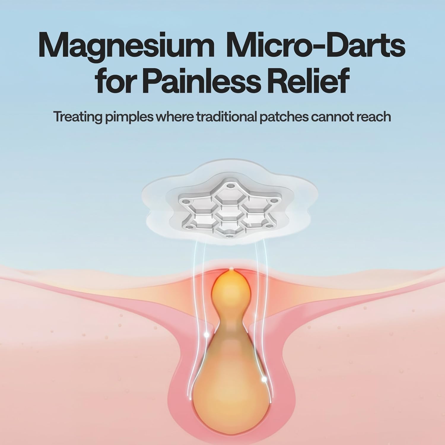 ELLE Magnesium Acne Patch |Micro-Dart | Magnesium - The Magic Mineral | Deep Penetrating Hydrocolloid Pimple Patch | Early Stage & Pus Pimples | Tea Tree & Madecassic Acid | 10 Patches