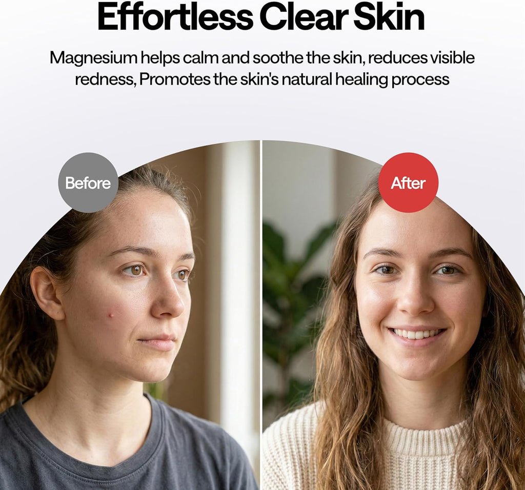 ELLE Magnesium Acne Patch |Micro-Dart | Magnesium - The Magic Mineral | Deep Penetrating Hydrocolloid Pimple Patch | Early Stage & Pus Pimples | Tea Tree & Madecassic Acid | 10 Patches