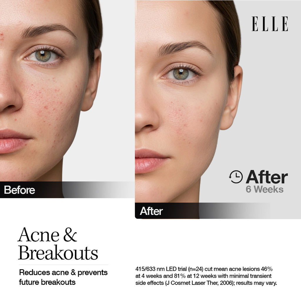 ELLE LED Mask — Radiance Boost Pro Facewear