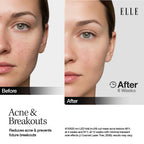 ELLE LED Mask — Radiance Boost Pro Facewear