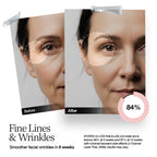 ELLE LED Mask — Radiance Boost Pro Facewear